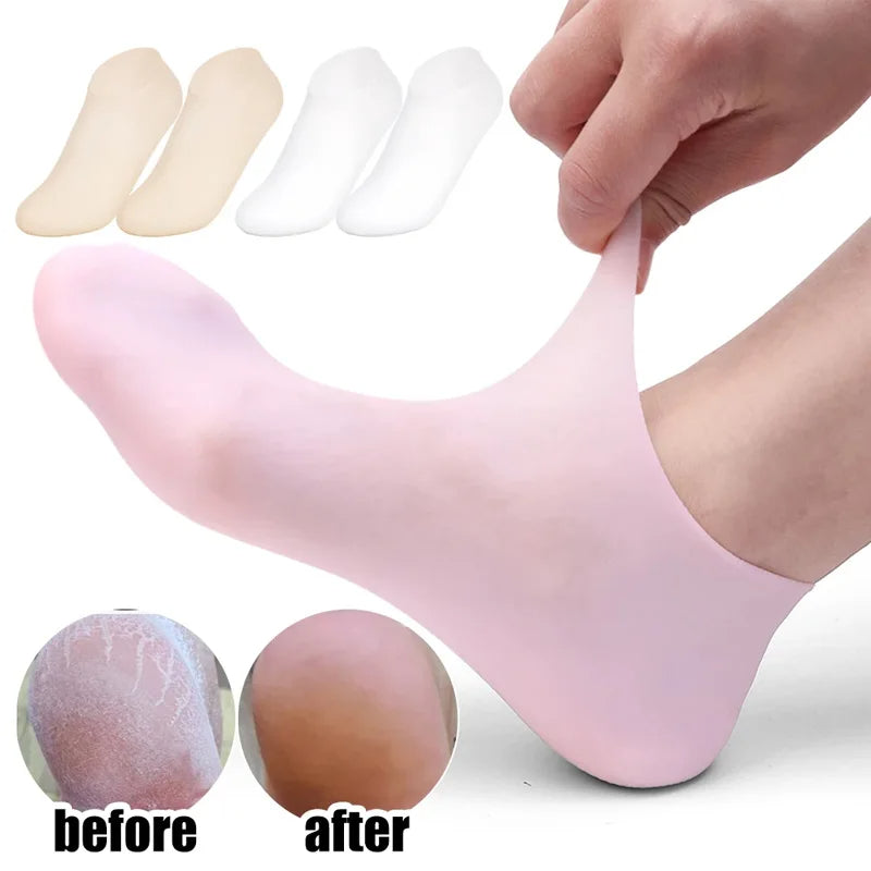 Silicone Gel Heel Socks for Cracked Heels – Moisturizing & Repair
